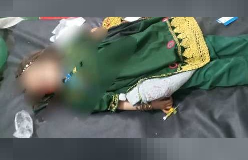 لوګر کې د ډزو له کبله دوو ماشومانو ته مرګ ژوبله رسيدلې